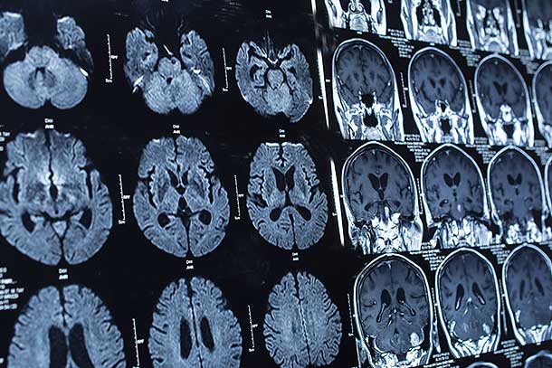 Servicios de radiología en el Sistema de Salud del Noroeste de Texas en Amarillo, Texas