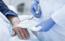 Un médico tratando una herida en la mano.